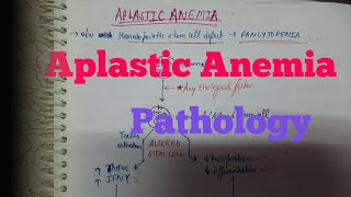 Aplastic anemia Pathology [upl. by Jc]