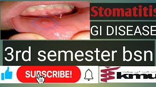 stomatitisGastrointestinal disease 1 stomatitisKMU BSN 3rd semester AHN types of stomatitis [upl. by Airotna894]