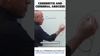 Cerebritis And Cerebral Abscess drnajeeb drnajeeblectures shortvideostatus [upl. by Ferd]