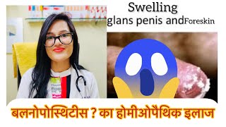 बलनोपोस्थिटीस Balanoposthitis Best Homeopathic Medicine Candida Balanitis Phimosis Dr Rukmani [upl. by Alric]