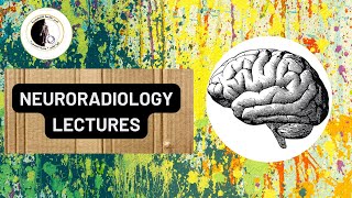 Tumors of the spine Part 1  Prof Dr Nahed Abdelgaber [upl. by Docia]