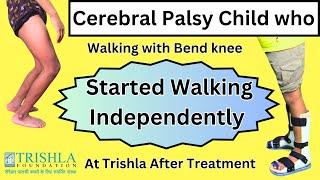 Dystonic Diplegic Cerebral Palsy with Crouch Gait got Excellent Walking Capability after treatment [upl. by Monarski19]