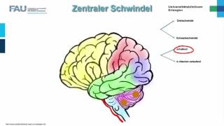 HNO ─ Schwindel Teil 22 [upl. by Adnole]