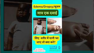 Edema  शरीर में सूजन  Ferrum met 30 homeopathic [upl. by Lloyd270]