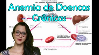 Anemia de Doenças Crônicas [upl. by Haeel721]