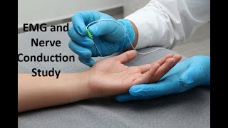 What to Expect EMG and Nerve Conduction Study [upl. by Izmar]