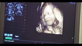 3D or 4D Scan 26 Weeks  32 Weeks [upl. by Ahseekan480]