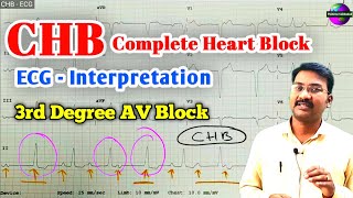 Complete Heart Block ECG  3rd Degree Av Block ECG  CHB ECG pstamil ps [upl. by Alah232]