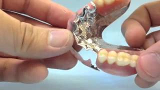 swinglock denture [upl. by Legge]