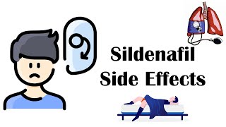 Sildenafil Viagra  Side Effects [upl. by Eidur446]