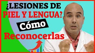 Enfermedad celiaca SINTOMAS ➡️ digestivos y no digestivos que 🤔 ni imaginas [upl. by Eeima]