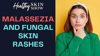 Malassezia And FUNGAL Skin Problems  Dr Julie Greenberg [upl. by Dorotea]