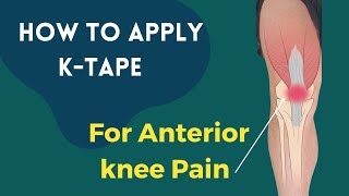 How to apply Kinesiology tape for knee pain  Patella Femoral Syndrome  Osgood Schlatters Syndrome [upl. by Namlak618]