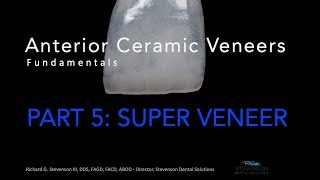 Anterior Ceramic Veneers Part 5 Super Veneer [upl. by Bate]