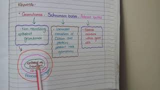 Sarcoidosis Histopathology  Granulomas Schaumann bodies Asteroid bodies [upl. by Latrell]