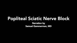 Popliteal Sciatic Nerve Block  Ultrasound [upl. by Inalawi337]