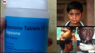 Dapsone 100mg tablets for leprosy and acne treatment Dapsone tabletes uses benefits [upl. by Skeie914]