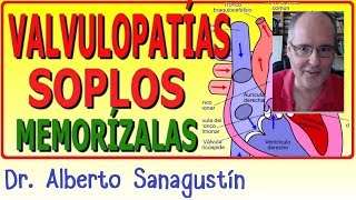 Memoriza las VALVULOPATÍAS y SOPLOS ✅ rápido y fácil [upl. by Curtis843]