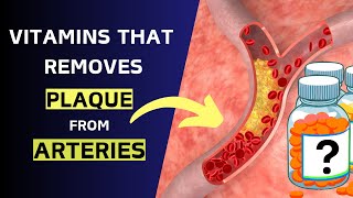 Vitamins That Remove Plaque from Arteries  Natural Heart Health Tips [upl. by Fokos]