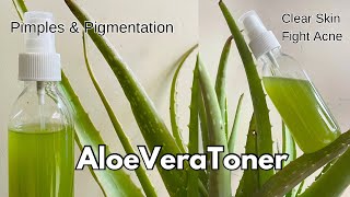 DIY Aloe Vera Toner for Clear Skin  Acne Pimples amp Pigmentation [upl. by Ole]