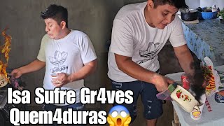 🚨UrgenteIsaias Sufre Gr4ves Quem4duras Al Prepar4r Su Comid4‼️Nunca Imagino Que Seria Tan Dificil😱 [upl. by Melisande190]