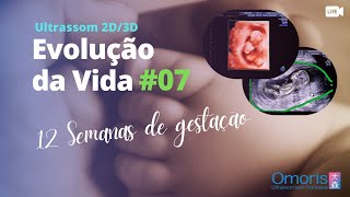 Gravidez 12 semanas Ultrassom morfológico translucência nucal Evolução da Vida 07 [upl. by Idihc]