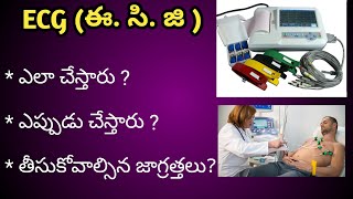 ECG test  ఈ సి జి పరీక్ష  for Heart Procedure in Telugu [upl. by Einberger]