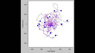 Myosin 6 in breast cancer cells – Video S1 479151 [upl. by Bradly277]