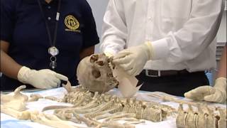 Medical Examiner System Evidence Guidelines [upl. by Leesen]