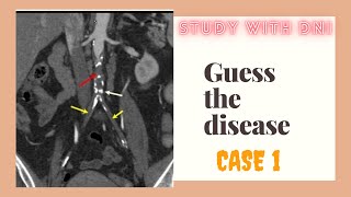 guess the disease  study with DNI  case 1 [upl. by Hooke]