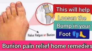 Bunion pain relief home remedies [upl. by Duggan]