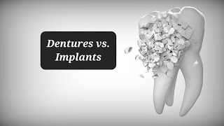 Dentures vs Dental Implants why I chose Dentures [upl. by Ted]