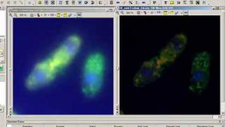 Image Deconvolution with AutoQuant Software [upl. by Thesda]