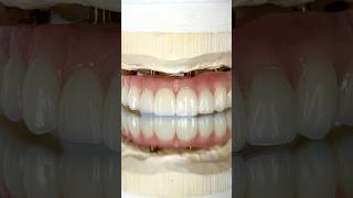 Maxillary Zirconia Arch Implant lsk121shorts dentist teeth [upl. by Livi806]