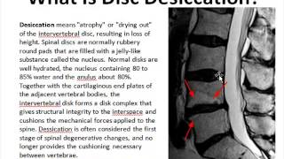 Disc Desiccation [upl. by Eahsal]