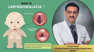 Laryngomalcia Stridor Symptoms Diagnosis amp Treatment I Dr Ankit Parakh Child Pulmonologist [upl. by Sirc256]