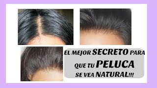 EL MEJOR SECRETO PARA QUE TU PELUCA SE VEA NATURAL ACLARANDO LOS NUDITOS [upl. by Ecart47]