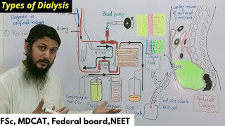 hemodialysis and peritoneal dialysis  types of dialysis [upl. by Nahgem]