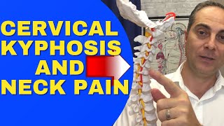 Cervical Kyphosis And Neck Pain REVERSAL CERVICAL LORDOSIS Dr Walter Salubro Chiropractor In Vaughan [upl. by Osnola187]