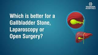 Which is better for a Gallbladder Stone Laparoscopy or Open Surgery [upl. by Ahsiniuq]