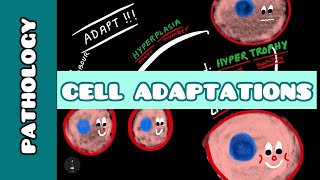 Cell Adaptation  Pathology  Ayan Parichha [upl. by Aile]