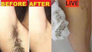 In 5 Minutes Remove Unwanted Hair Permanently NO SHAVE NO WAX Painlessly Remove Unwanted Hair [upl. by Basso255]