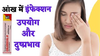 आंख में इन्फेक्शन की दवा  chlorocol h eye ointment in hindi  eye infection [upl. by Roosevelt]