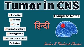 Tumor in CNS  Pathology  Hindi  Gross and Microscopic Pathology  Pathogenesis [upl. by Adiaros]