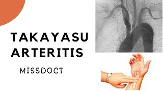 TAKAYASU ARTERITIS The Pulseless Disease [upl. by Map]