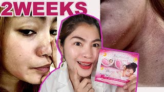 BRILLIANT SKIN REJUVENATING SET  IWASAN ANG Kati Hapdi PAMUMULA TIPS  HONEST REVIEW NO TO SUNOG [upl. by Glenn]