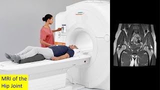 Magnetic Resonance Imaging MRI of the Hip Joint [upl. by Ynaffital901]