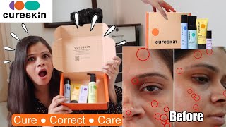 Cureskin App amp Products Review amp Everything In Between  Honest Cureskin Review  Kamna Sharma [upl. by Noffihc]