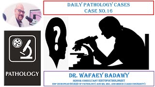 DAILY PATHOLOGY CASES CASE NO 16 BY DR WAFAEY BADAWY [upl. by Bulley419]