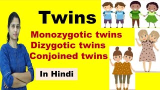 Twins  Types of Twins  Monozygotic Twins amp Dizygotic Twins  in Hindi [upl. by Brittany]